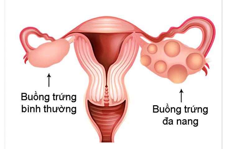 Hoi-chung-buong-trung-da-nang