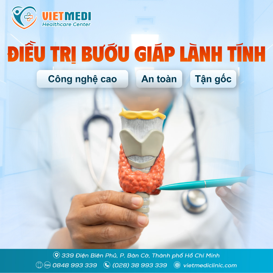 Điều trị bướu giáp