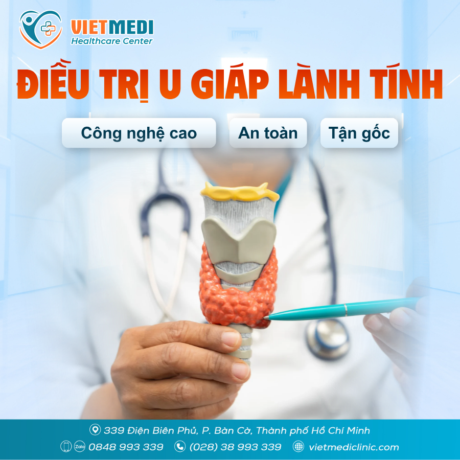 Điều trị u tuyến giáp