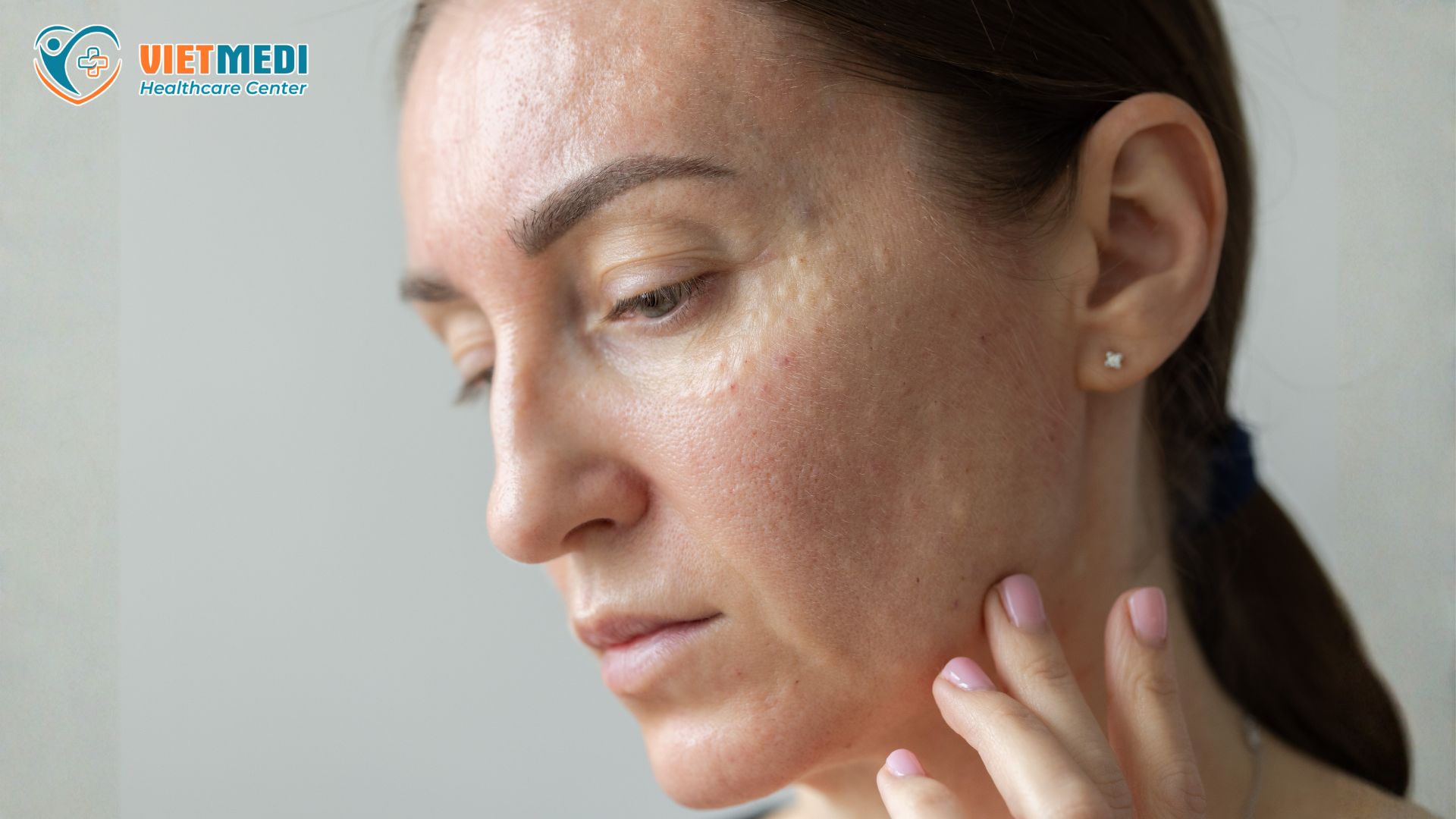 cay-tinh-chat-tri-nam-5