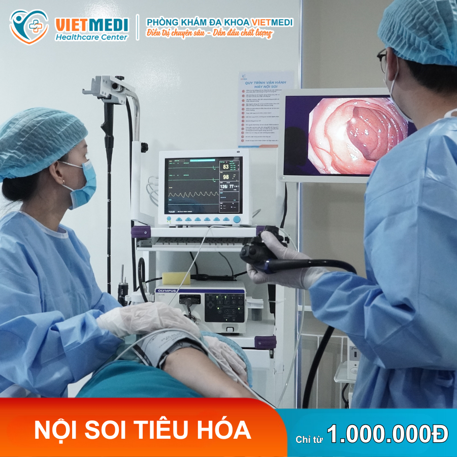 Nội soi tiêu hóa