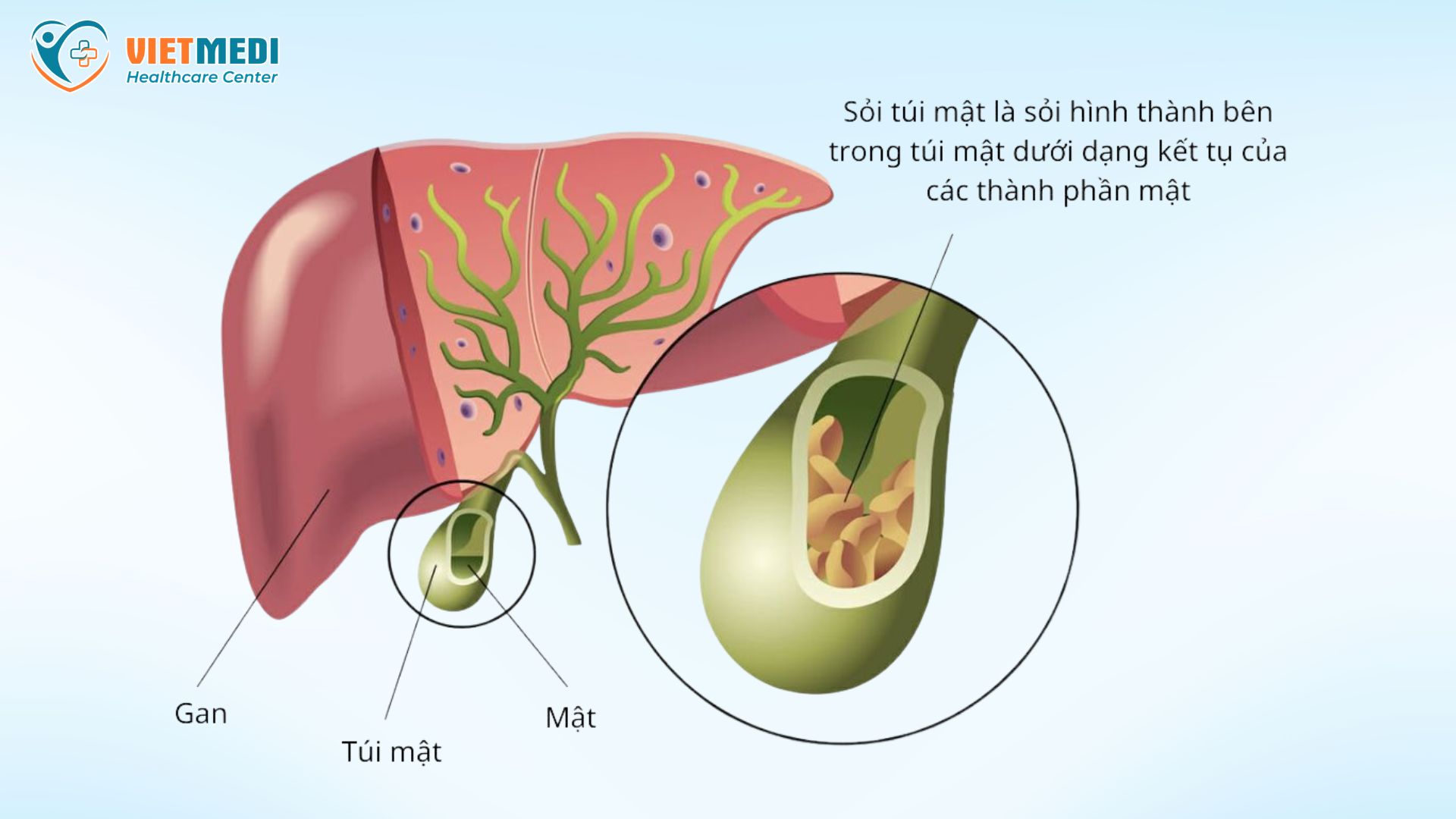 soi-tui-mat-6