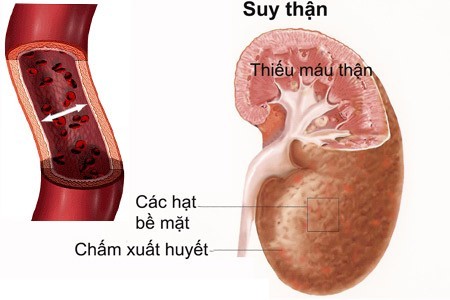 suy-than-co-con-duoc-khong