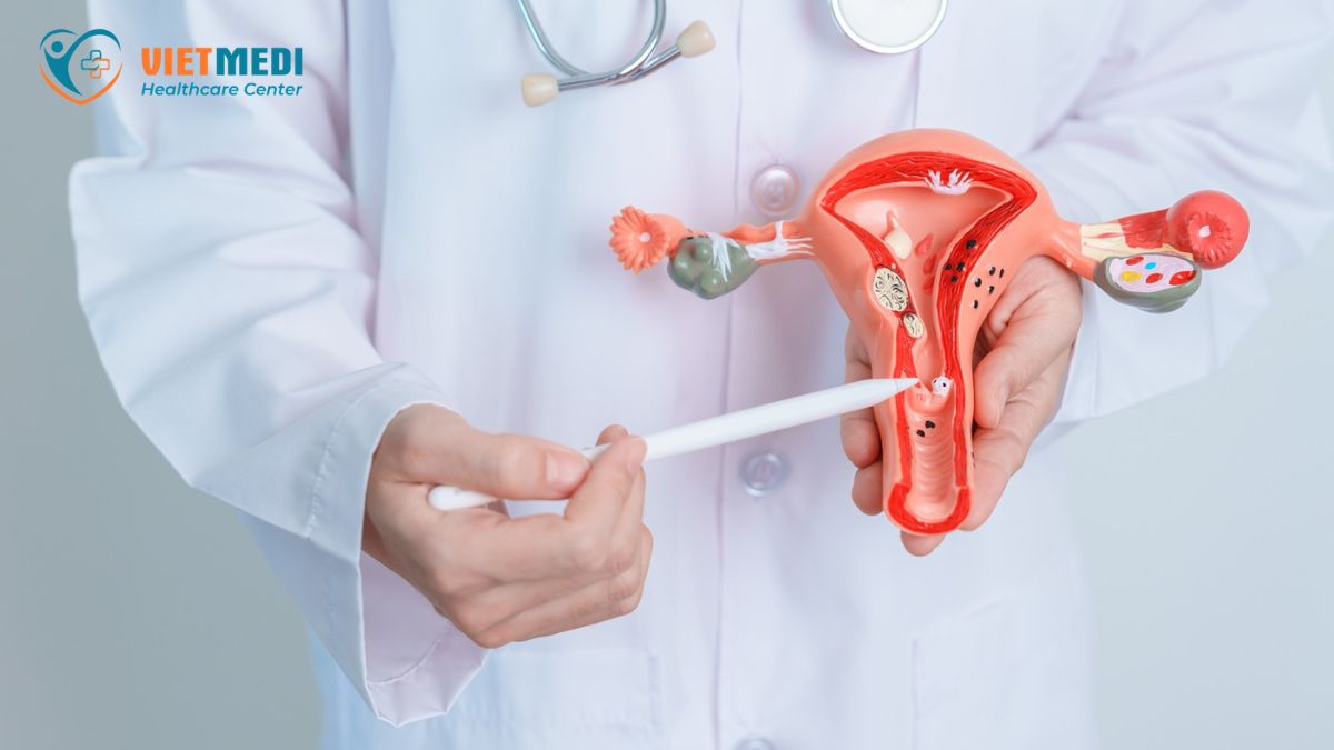 tam-soat-ung-thu-co-tu-cung-gia-bao-nhieu-4