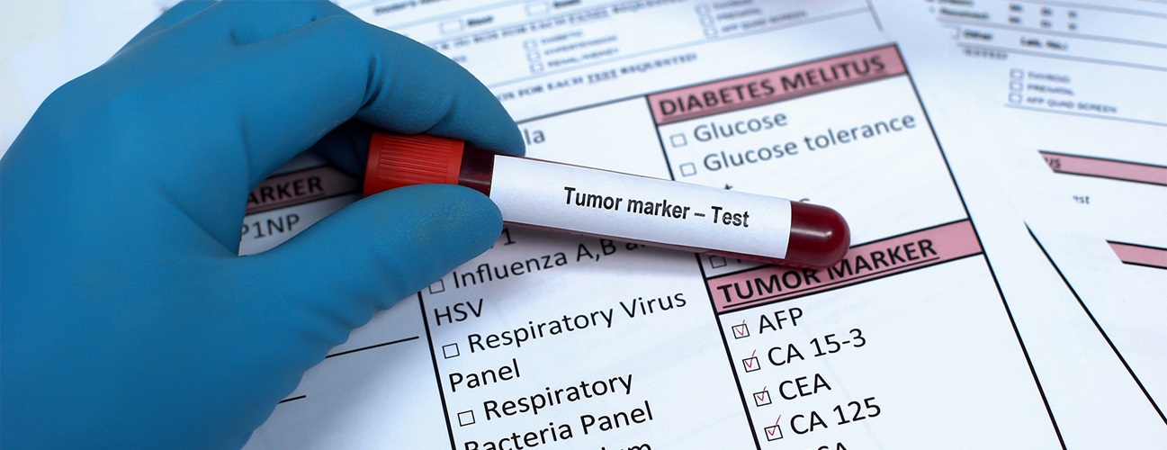 tumor maker