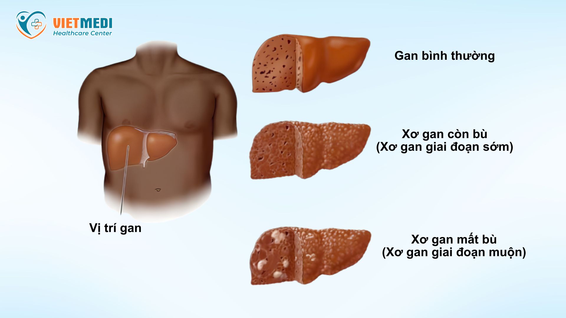 viem-gan-2