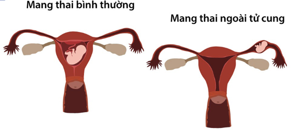 viem vung chau