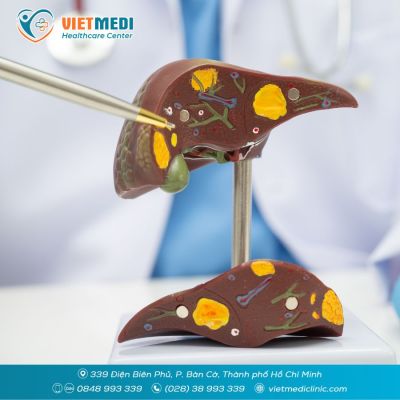 SỎI T&Uacute;I MẬT: DẤU HIỆU NHẬN BIẾT, BIẾN CHỨNG V&Agrave; PHƯƠNG PH&Aacute;P ĐIỀU TRỊ CHUẨN Y KHOA