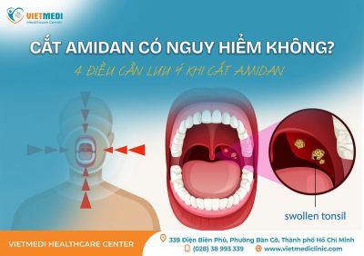 CẮT AMIDAN CÓ NGUY HIỂM KHÔNG? 4 ĐIỀU CẦN LƯU Ý KHI CẮT AMIDAN