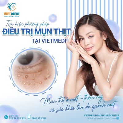 MỤN THỊT QUANH MẮT - CẢNH BÁO SỨC KHỎE HAY CHỈ LÀ VẤN ĐỀ THẨM MỸ?