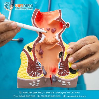 BỆNH TRĨ: DẤU HIỆU NHẬN BIẾT, NGUY&Ecirc;N NH&Acirc;N V&Agrave; C&Aacute;C PHƯƠNG PH&Aacute;P ĐIỀU TRỊ TI&Ecirc;N TIẾN
