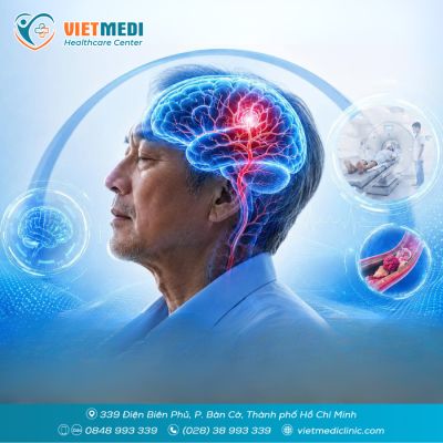 ĐỘT QUỴ: NHẬN DIỆN NGUY CƠ TỪ SỚM ĐỂ CHỦ ĐỘNG PH&Ograve;NG NGỪA