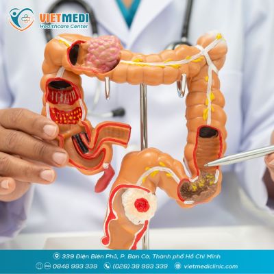 POLYP ĐẠI TR&Agrave;NG: KHI N&Agrave;O CẦN CẮT V&Agrave; BAO L&Acirc;U N&Ecirc;N NỘI SOI LẠI?