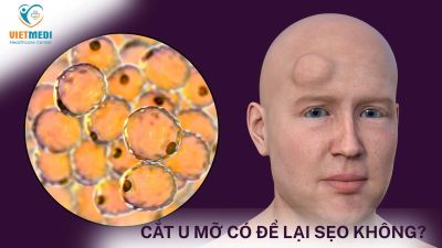 CẮT U MỠ CÓ ĐỂ LẠI SẸO KHÔNG? CÁCH CHĂM SÓC SAU MỔ