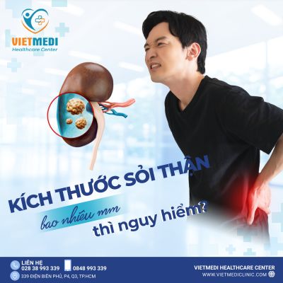 KÍCH THƯỚC SỎI THẬN BAO NHIÊU THÌ NGUY HIỂM?