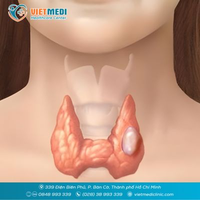 PH&Aacute;T HIỆN NH&Acirc;N TUYẾN GI&Aacute;P: KHI N&Agrave;O L&Agrave;NH T&Iacute;NH, KHI N&Agrave;O NGUY HIỂM?