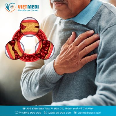 ĐIỀU TRỊ BỆNH ĐỘNG MẠCH V&Agrave;NH: TỪ THAY ĐỔI LỐI SỐNG ĐẾN CAN THIỆP CHUY&Ecirc;N S&Acirc;U