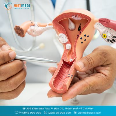 TẦM SO&Aacute;T UNG THƯ CỔ TỬ CUNG GI&Aacute; BAO NHI&Ecirc;U?