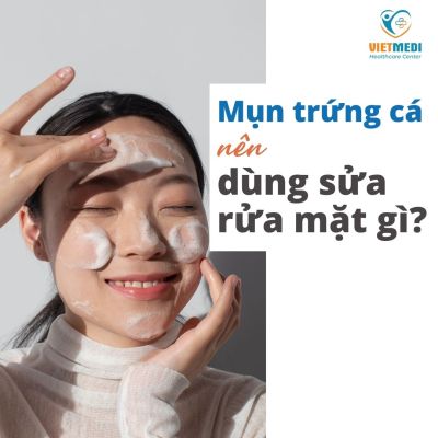 SỬA RỬA MẶT PHÙ HỢP VỚI MỤN TRỨNG CÁ